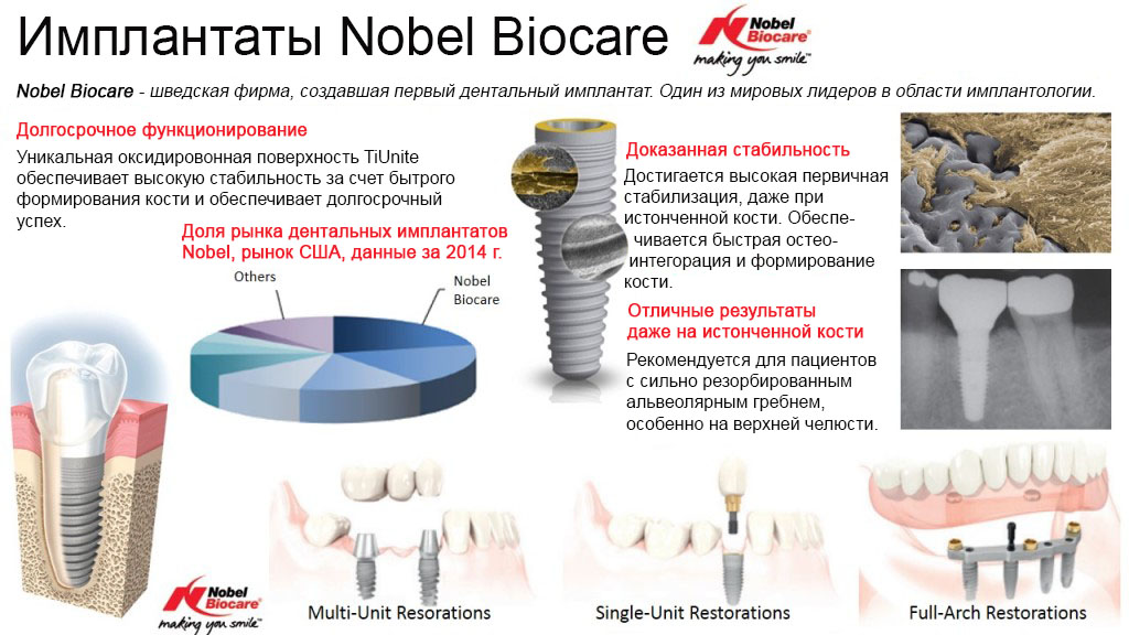 Варианты применения для восстановления зубов